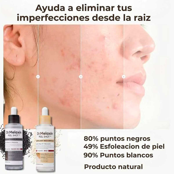 Esencia Exfoliante de Arroz