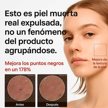 Esencia Exfoliante de Arroz Dr. Melaxin
