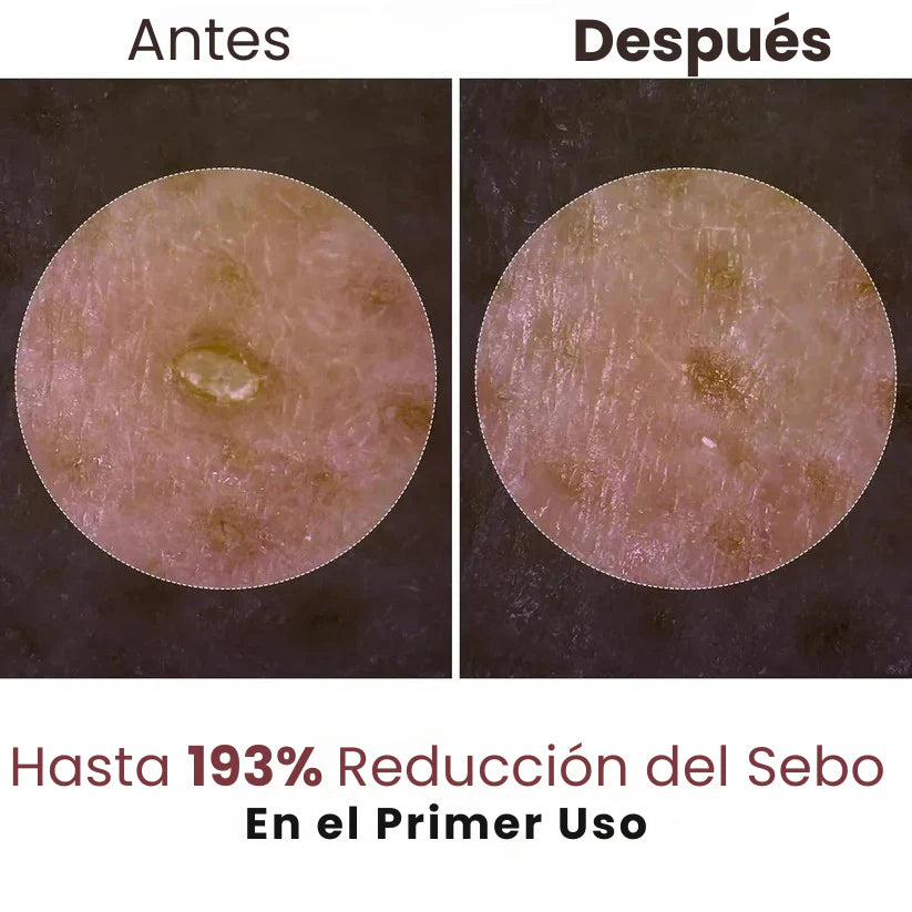 Esencia Exfoliante de Arroz Dr. Melaxin