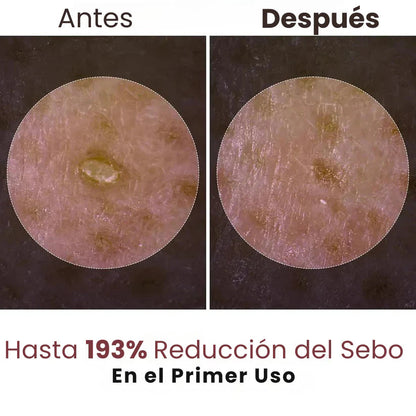 Esencia Exfoliante de Arroz Dr. Melaxin