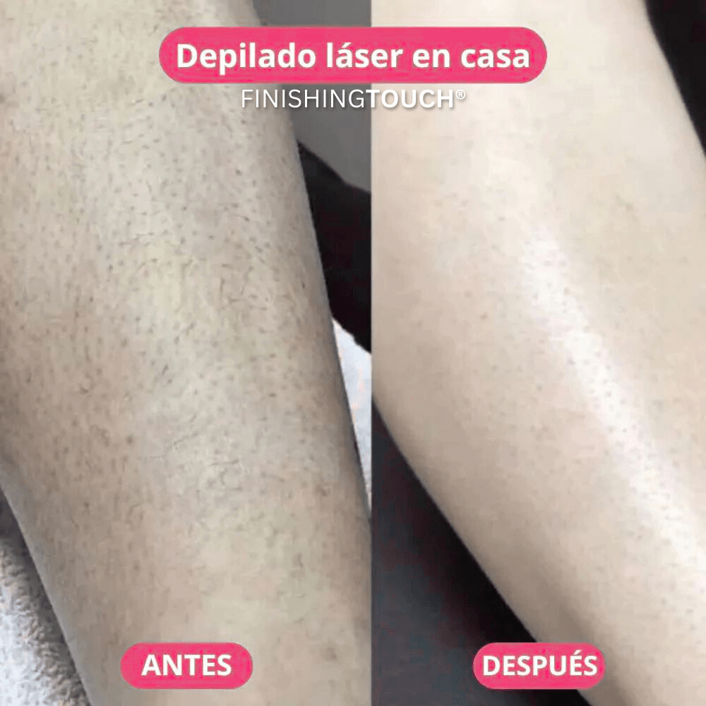 Depiladora Luz Láser Sin Dolor