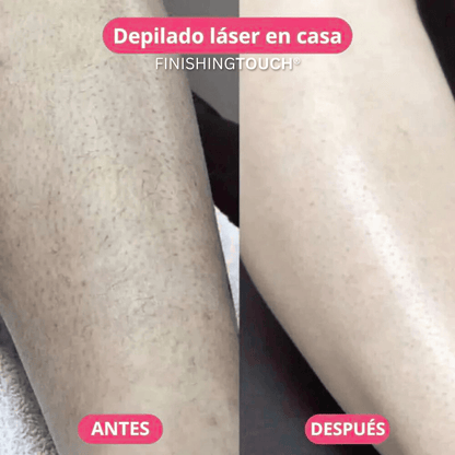 Depiladora Luz Láser Sin Dolor