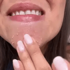 Esencia Exfoliante de Arroz Dr. Melaxin
